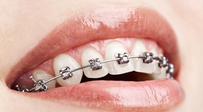 damon-orthodontics.jpg